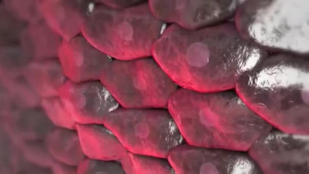 Atherosclerosis Menyebabkan Serangan Jantung — Stok Video