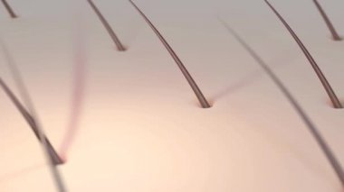 Sivilceler, Gelişim Aşamaları, Grafik Canlandırması