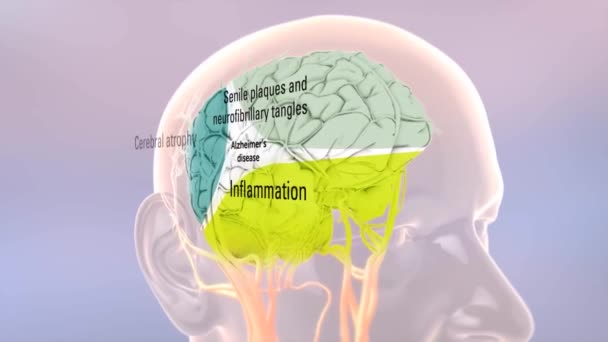 Procesamiento Proteínas Precursoras Amiloides Enfermedad Alzheimer — Vídeo de stock