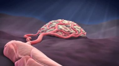 Kılcal damarlardaki uzaysal olarak izole edilmiş kasılmalı hücrelerin, serebral kan akışını fizyolojik olarak kontrol ettiği ve iskemiden sonra iskemiden sonra kan akışını kısıtladığı, kılcal damarları daraltarak ve sonra da ölmesiyle.