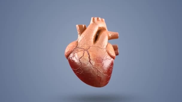 心臓発作 冠状動脈が強調表示されます 動脈をブロックとして打つコレステロール歯垢や心停止の詳細を使用してズームイン — ストック動画