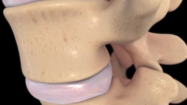 Annulus fibrosus, iç çekirdek çekirdeği olan çekirdek pulposusu çevreleyen omurlar arası diskin sert dairesel dış görünüşüdür.. 