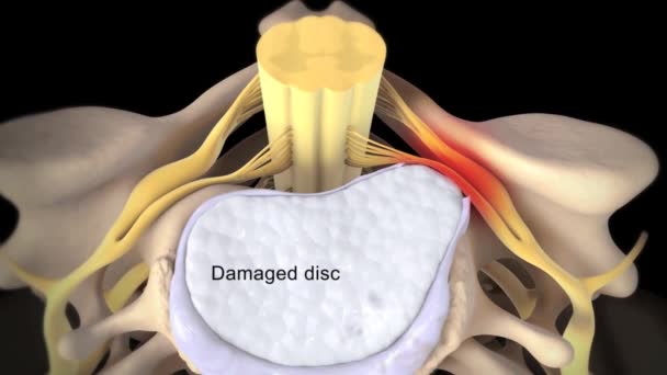 Nervos Cervicais São Nervos Espinhais Das Vértebras Cervicais Segmento Cervical — Vídeo de Stock