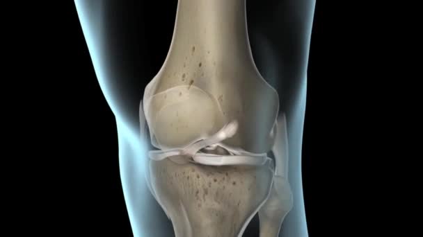 Vorderen Kreuzbandes Acl Surgery Knee Tep — Stockvideo