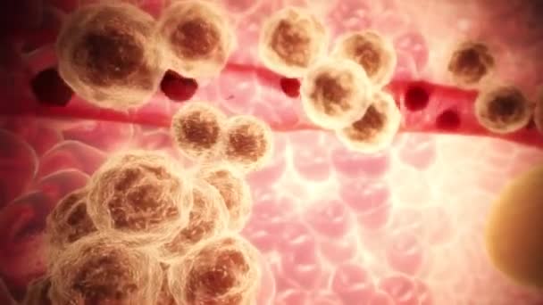 Cellule Tumorali Che Causano Metastasi Tumore Canceroso Resa Animazione — Video Stock