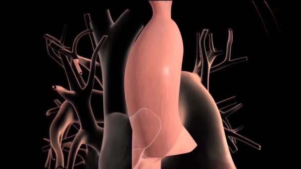 Sindrome Ipoplastica Del Cuore Sinistro Raro Difetto Cardiaco Congenito Cui — Video Stock