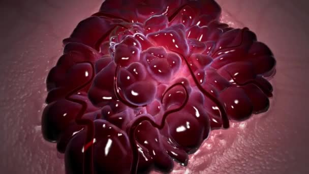胎记是在出生时可见的细胞和结构的累积 这些胎记可以分为色素胎记和血管胎记 — 图库视频影像