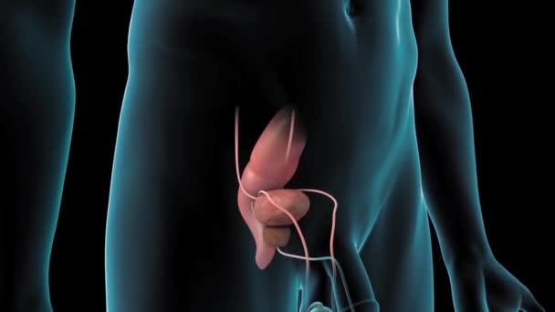 Animazione Clinicamente Accurata Del Cancro Alla Prostata — Video Stock