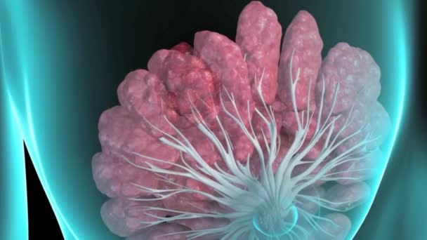 Brustkrebs Brustanatomie Wachsender Tumor Krebs Der Den Zellen Der Brüste — Stockvideo