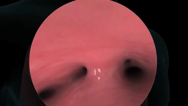 Médico Que Verifica Estado Los Pulmones Con Broncoscopio Imagen Fluorescente — Vídeos de Stock