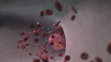 Akciğer embolisi, çoğunlukla kan pıhtılaşması olan bir madde akciğerinizdeki bir arterde sıkışınca meydana gelir. Bu kan pıhtıları genellikle bacaklarınızın derin damarlarından çıkar. Bu durum derin ven trombozu olarak bilinir.