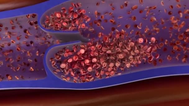 Koagulace Proces Kterým Krev Mění Tekutiny Gel Tvořící Krevní Sraženinu — Stock video