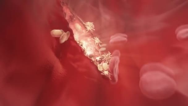 Коагуляція Процес Якому Кров Змінюється Від Рідини Гелю Утворюючи Тромб — стокове відео