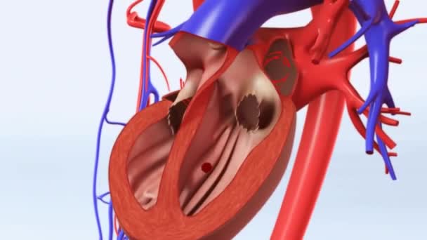 Θρόμβος Που Σχηματίζεται Στην Καρδιά Φτάνει Στον Εγκέφαλο Και Εμφανίζεται — Αρχείο Βίντεο