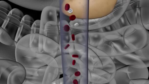 Diabetes Metabolic Disorder Caused High Levels Blood Sugar Render Animation — Stock Video