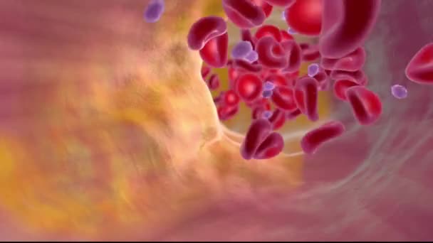 Hemophilia Coagulation How Blood Clots — Stock Video