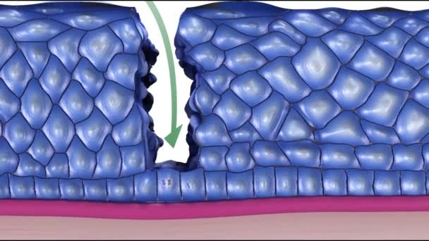 Nsan Papillomavirus Siğillere Bazı Türlerin Cinsel Organlara Bulaşmasına Rahim Ağzı — Stok video