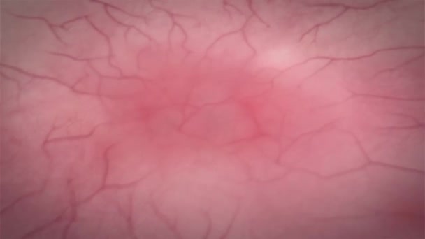 Questo Video Mostra Come Avviene Crescita Del Cancro Nel Corpo — Video Stock