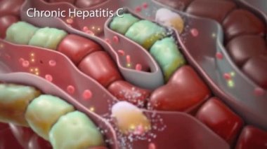 Tıbbi ilaçlı kronik Hepatit B