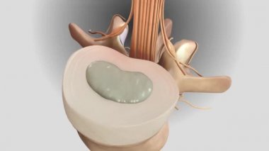 Servikal omurga. Kronik bel ağrısı.