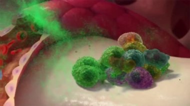 Çoklu Myeloma, beyaz kan hücrelerinden oluşan bir kanser türü.