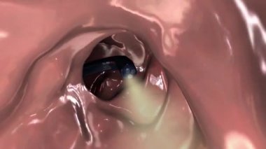 Kolonoskopi cihazı incelenerek tanıtılıyor