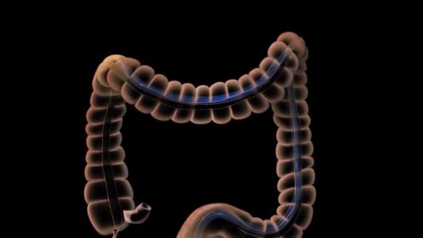 Système Digestif Sigmoïde Côlon Descendant Côlon — Video