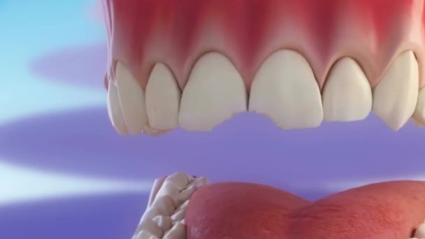 Processo Lascar Dentes Danificados — Vídeo de Stock