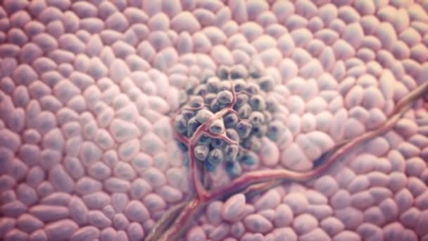 Kanser Hücre Bölümü Tümör Büyümesi Ilerlemesi Anormal Kontrolsüz Kanser Hücreleri — Stok video
