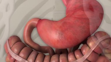 Başarısız ve midesi yaralı. Kanser, tümör dokusu sorunu, metastaz ve sağlık sorunları. Tıp bilimi, insan anatomisi, gastrointestinal yaralanma