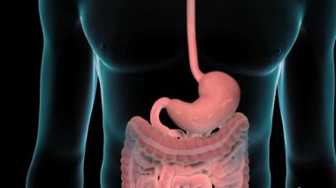 Gastrik ve duodenal ülser iki çeşit peptik ülserdir. Bir peptik ülser mide iç kısımlarında bir mide ülseri ya da ince bağırsağın üst kısmında bir duodenal ülserdir..