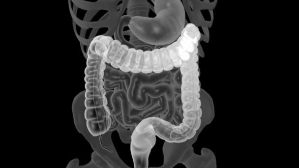 Пищеварительная Система Толстая Кишка — стоковое видео
