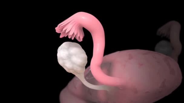 Quiste Que Forma Cuando Tejido Endometrial Mucosa Que Forma Capa — Vídeo de stock