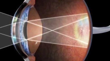 Göz anatomisi - iç yapı, tıbbi olarak doğru.