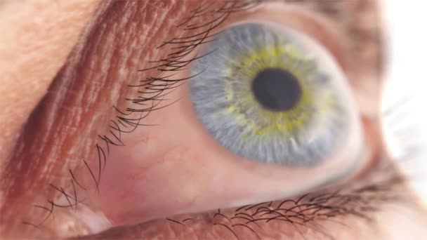 Dor Nos Olhos Inflamação — Vídeo de Stock