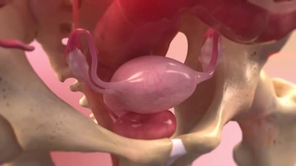 Remoção Tecido Endometrial — Vídeo de Stock
