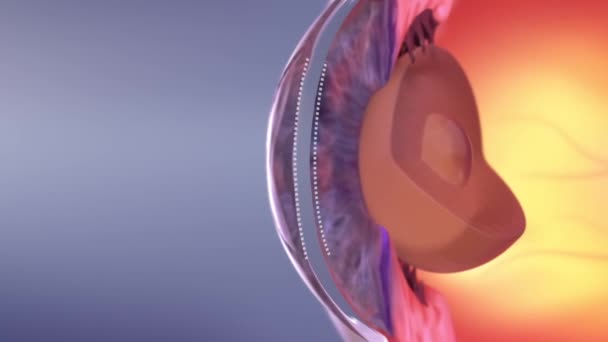 Laser Eye Surgery Eyes Anatomy — Stock Video