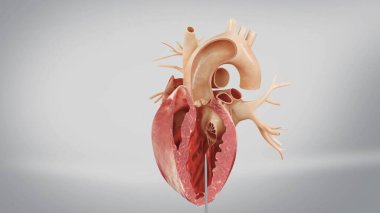 Aortic prosthesis surgery attachment of artificial prosthetic aortic valve to heart in 3D CG animated human model clipart