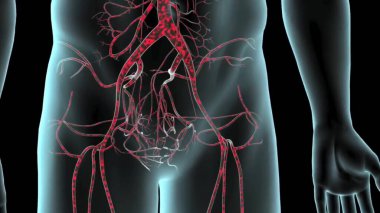 Abdominal aort anevrizması. Abdominal atardamar dolaşım sistemi. Abdominal aort ve anevrizmalı karın aortu sağlıklı. Siyah arkaplanda izole edilmiş düz biçim illüstrasyon