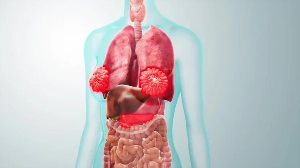 Enfermedad Pulmonar Dañada Rojo Renderizar Animación Problemas Respiratorios Problemas Médicos —  Fotos de Stock