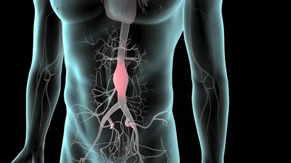 Аневризма Черевної Аорти Артеріальна Кровоносна Система Черевної Порожнини Здорова Аорта — стокове фото
