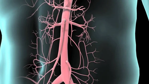 Anévrisme Aorte Abdominale Circulation Artérielle Abdomen Aorte Abdominale Saine Aorte — Photo