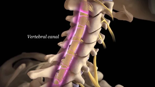 Visão Anatomicamente Correta Coluna Cervical Disco Intervertebral — Fotografia de Stock