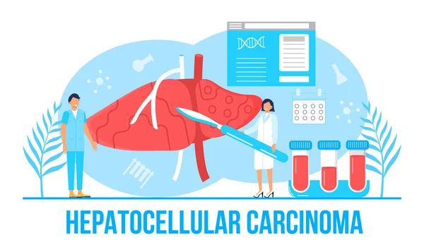 Vector conceptual del carcinoma hepatocelular. Hepatitis A, B, C, D, cirrosis, día mundial de la hepatitis. Médicos diminutos tratan el hígado — Vector de stock