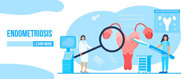 Hysteroscopy of uterus, womb concept vector. Endometriosis, endometrium dysfunctionality, removal of polyps are shown.