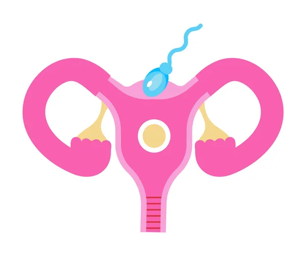 Uterus图标向量。内部女性器官。世界更年期，子宫内膜异位症说明。人类精子在运行，受精也在进行 — 图库矢量图片