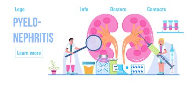 Urartrit, tıbbi web sitesi için üreteroskopi konsepti vektörü. Ürolog, nefrit illüstrasyonu. Küçük doktor böbrekleri tedavi eder. Pyelonefrit ve böbrek taşı hastalıkları..