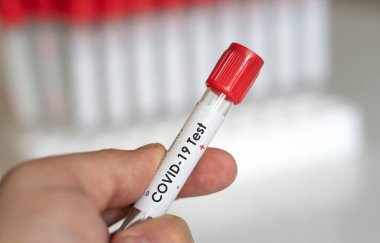 Pozitif koronavirüs kan testi konsepti. Doktor elinde Coronavirus testi için test tüpündeki kan örneğini analiz ediyorum. 2019-NCoV ya da COVID-19 testi için tüp. Coronavirus kan analizi konsepti