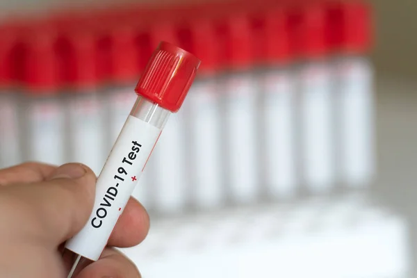 stock image Medical scientist hand holding COVID-19 test tube in hospital laboratory. Male doctor or physician getting result of Coronavirus case. 2019-nCoV lab test concept