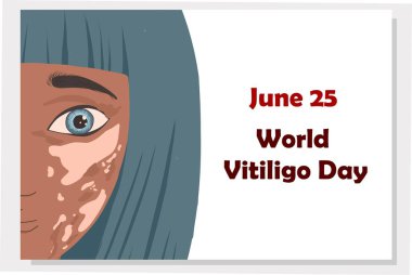 25 Haziran - Dünya Vitiligo Günü. Pigmentasyon bozuklukları. Cilt pıhtılaşması. Nadir hastalıklar konulu vektör illüstrasyon. Kronik deri hastalığı..